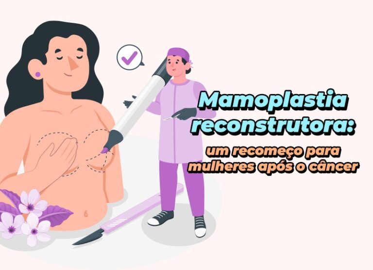 Mamoplastia reconstrutora: um recomeço para a mulher após o câncer