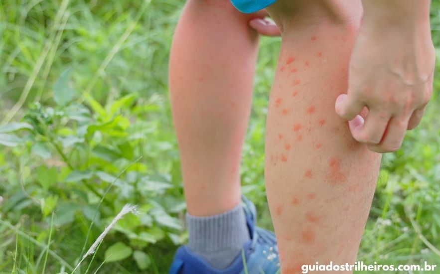 Identificando os Borrachudos: Conheça Seu Inimigo - inspiração 2