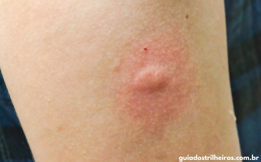 Repelentes Naturais: A Força da Natureza Contra as Picadas - inspiração 2