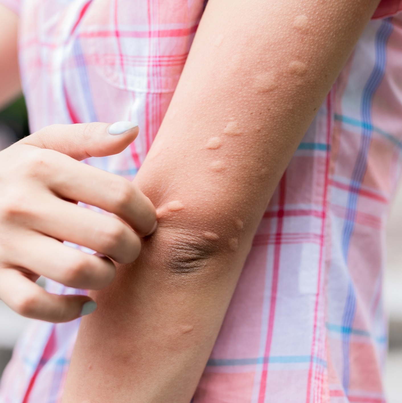 Remédios Caseiros para Alívio Rápido e Natural - inspiração 2