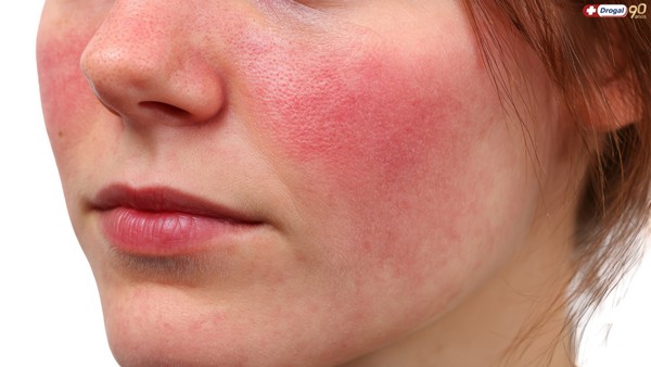 dicas para uma pele menos vermelha