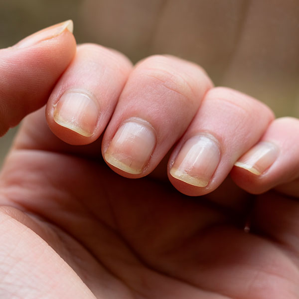 A Importância da Base para a Saúde das Unhas