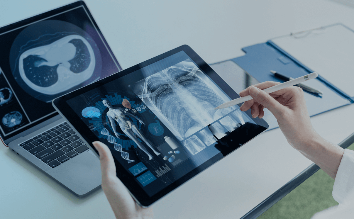 O papel da IA na radiologia: agilidade e precisão