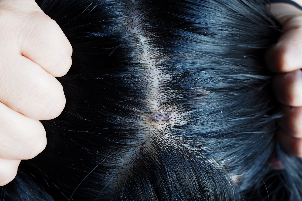 Melhores Shampoos Anticaspa: Guia Completo e Ativos Essenciais