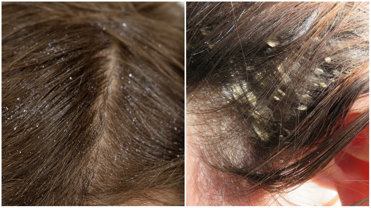 Sintomas e Tratamentos Eficazes