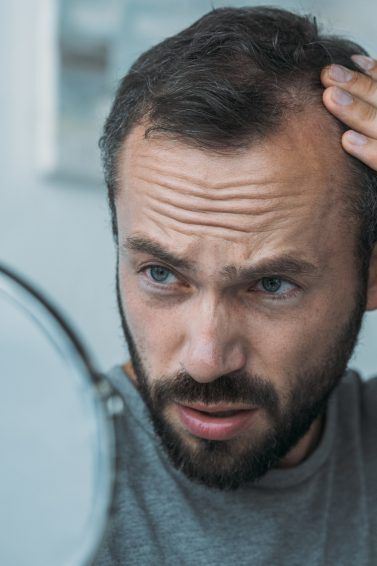 Como Escolher o Melhor Barbeiro para Cortes que Disfarçam a Calvície