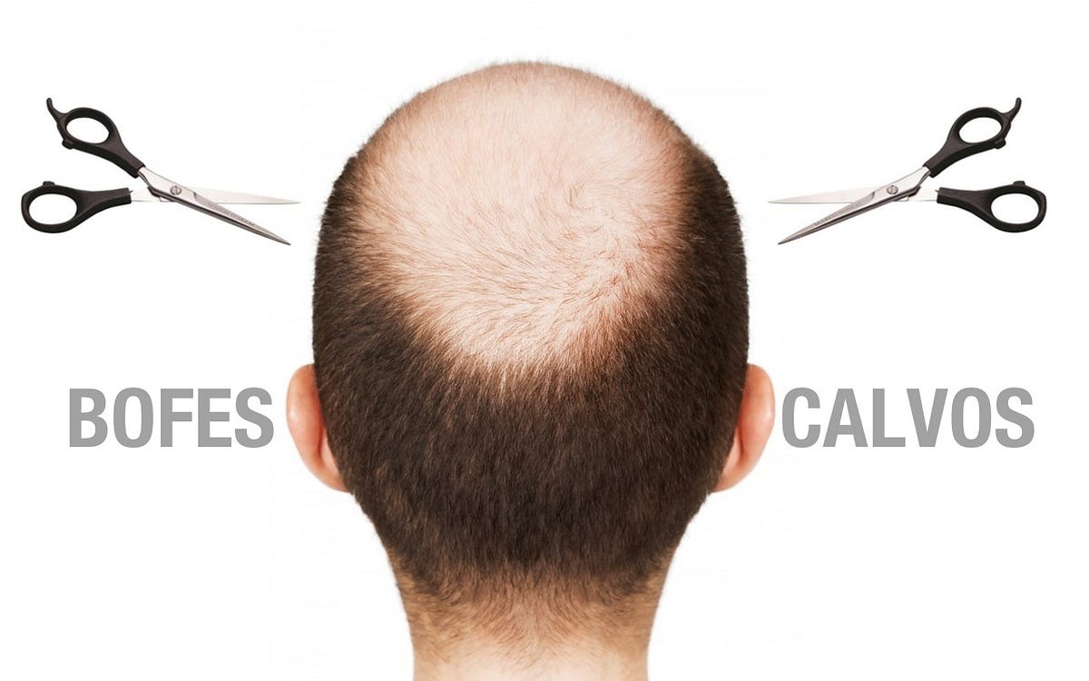 cortes de cabelo masculino para disfarçar a calvície