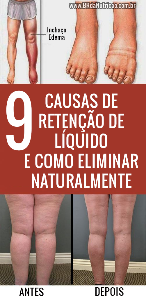 Drenagem Linfática: Benefícios e Como Funciona