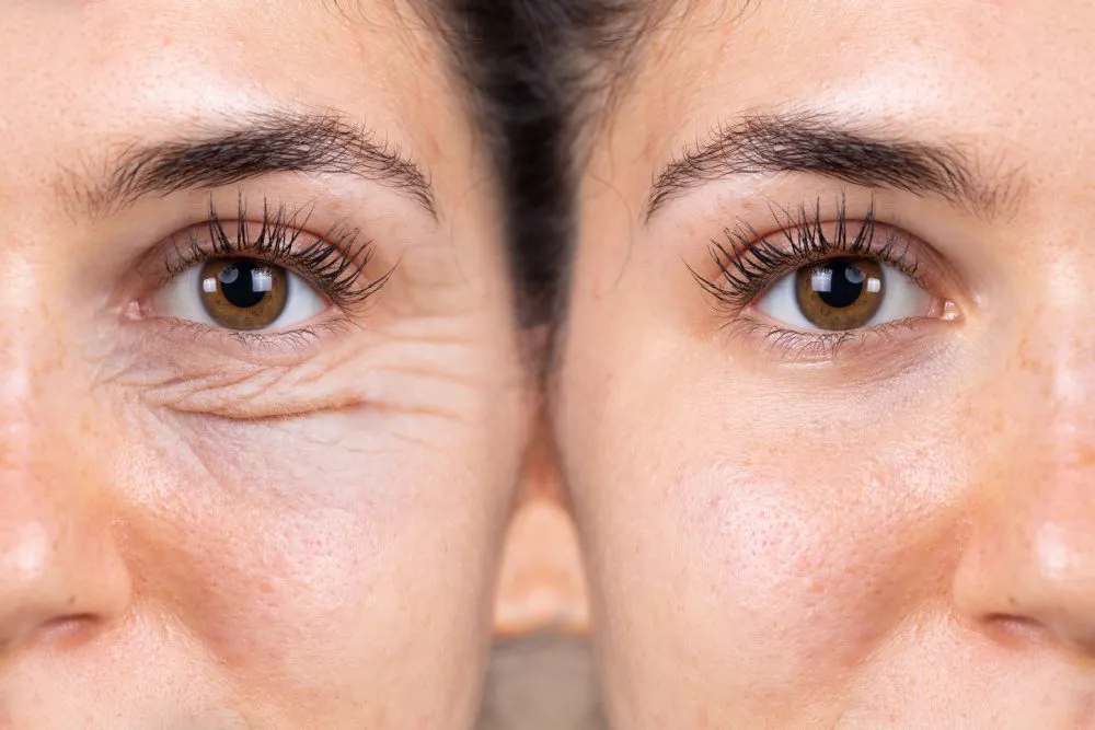 Exercícios Faciais para Rejuvenescer o Olhar: Fortalecimento da Pálpebra