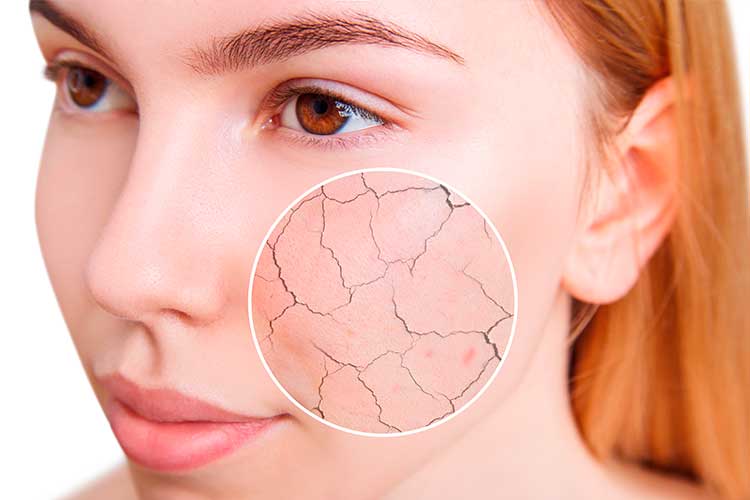 dicas para a base não transferir