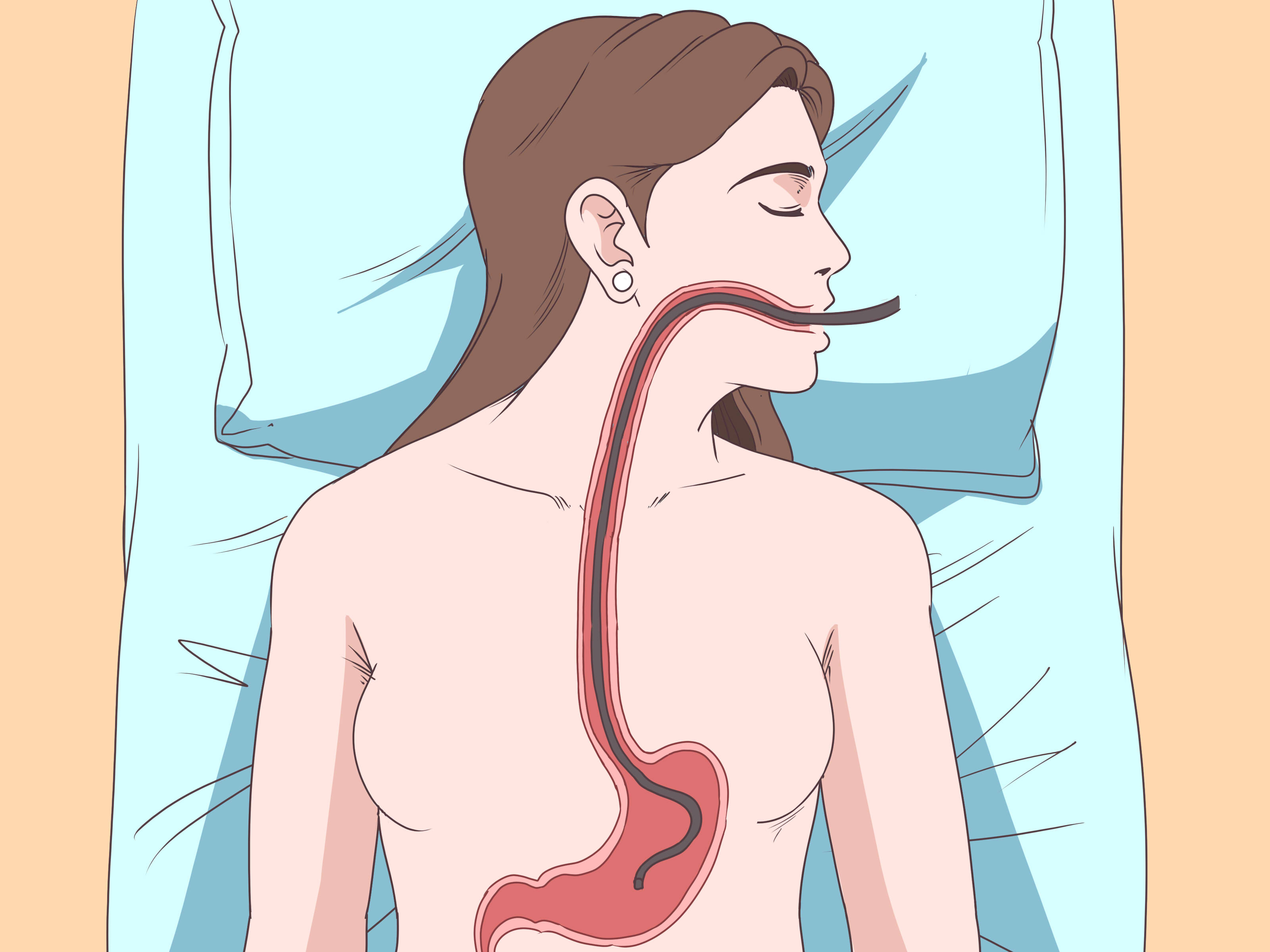 eructação causa dor de estômago