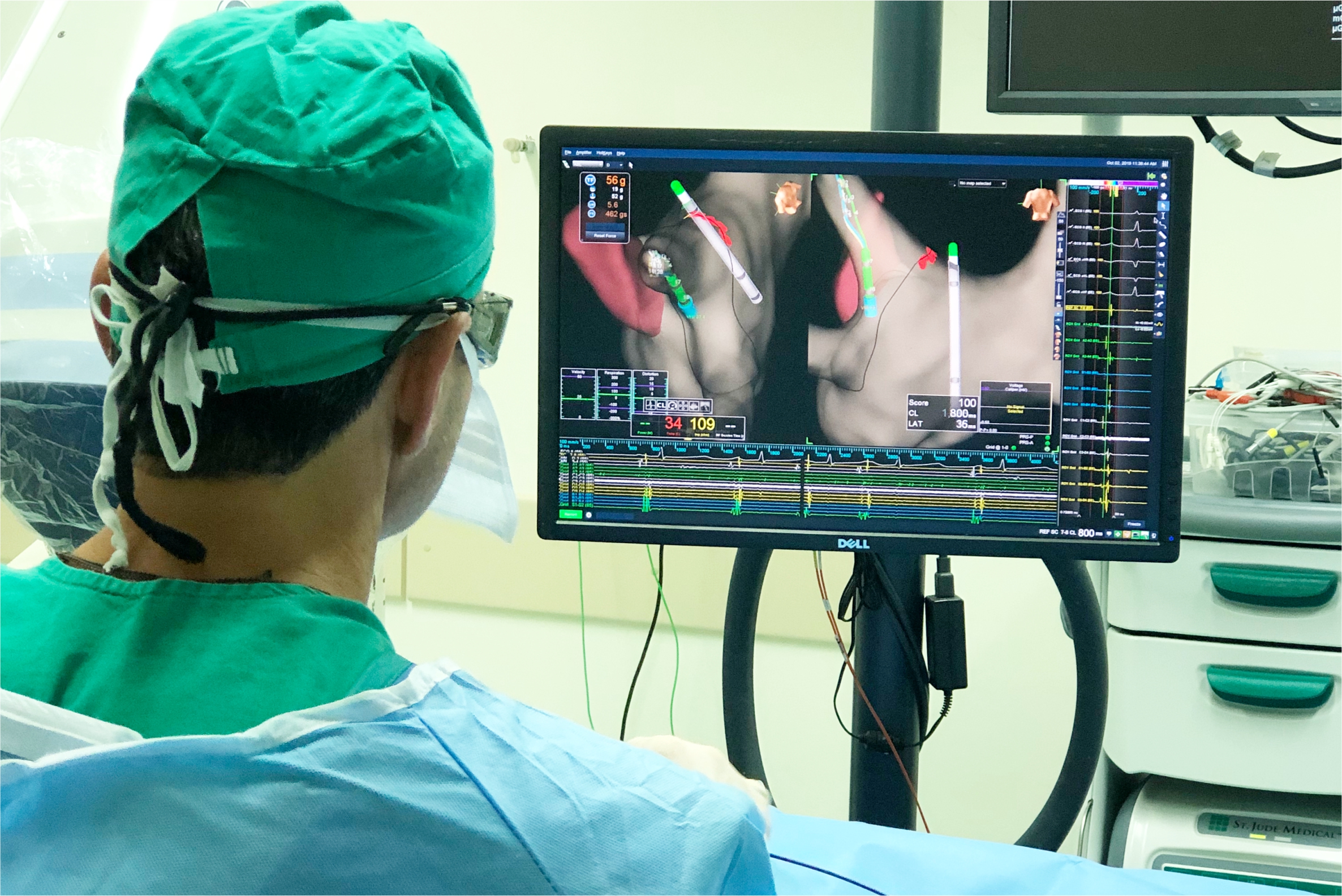 erros comuns em cateterismo cardíaco