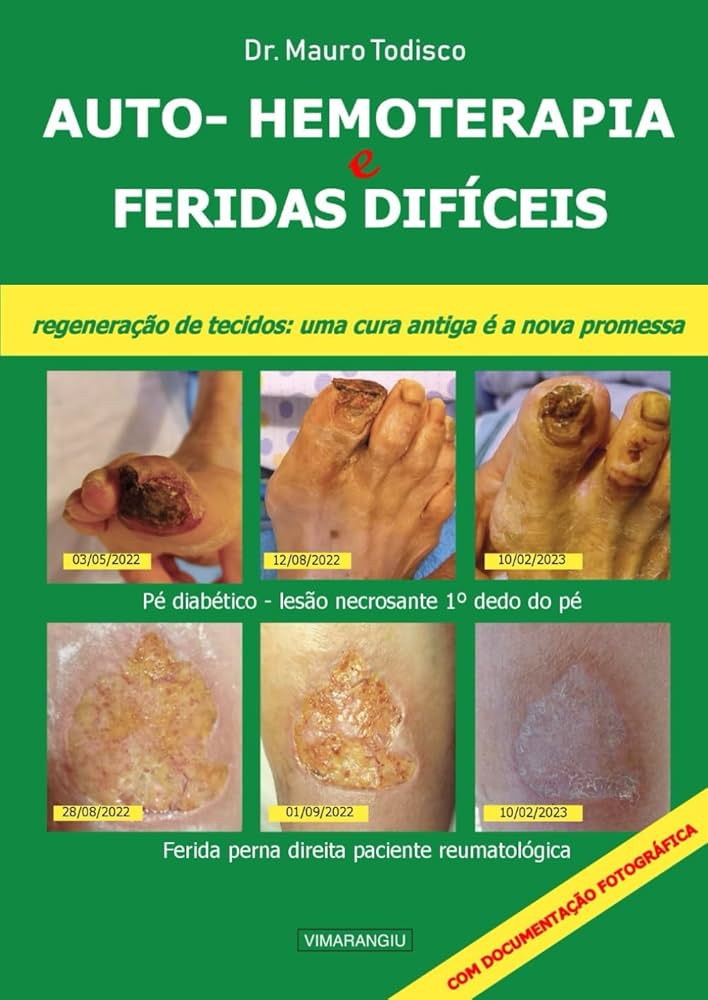 tipos de hemoterapia para cada doença
