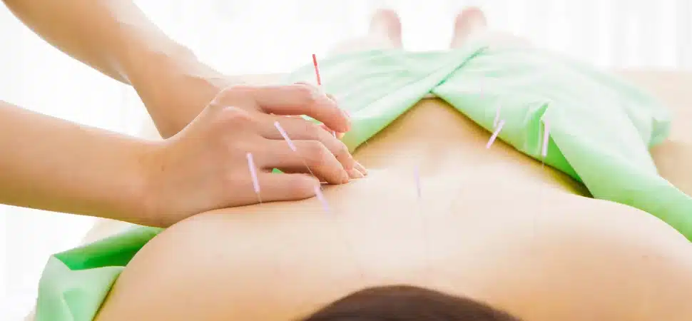 melhores pontos de acupuntura para dor nas costas