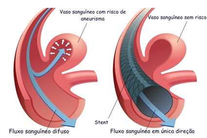 erros comuns ao ignorar dor de cabeça forte