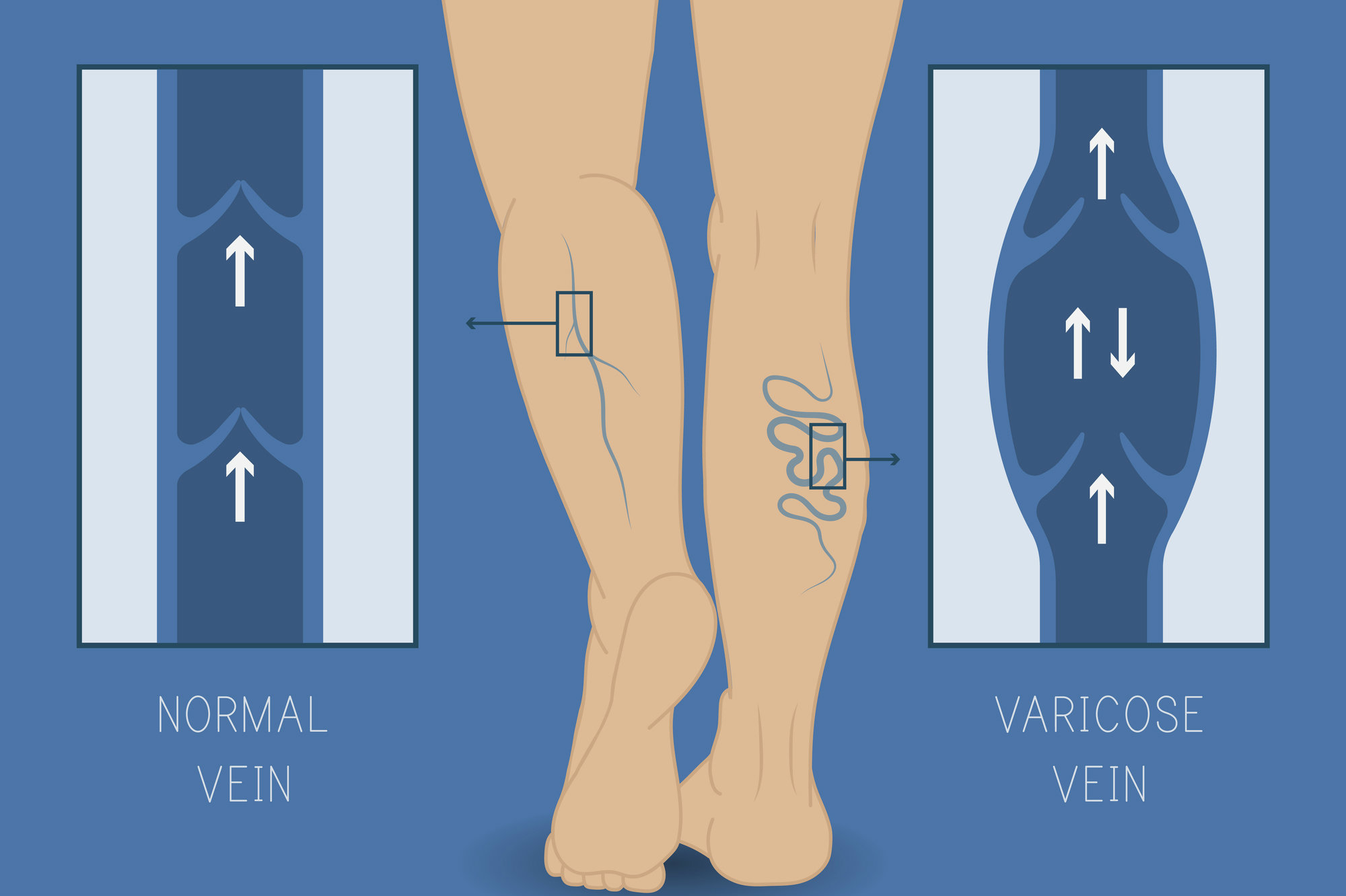 melhores tratamentos angiologia