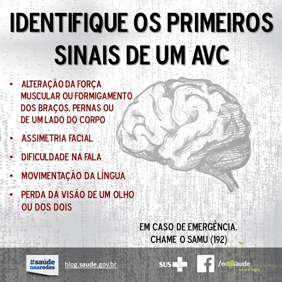 avc isquêmico