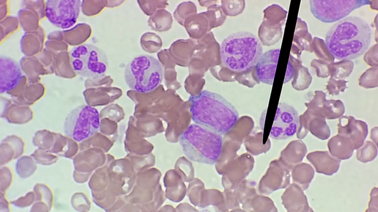 o que é bastonetes no exame de sangue