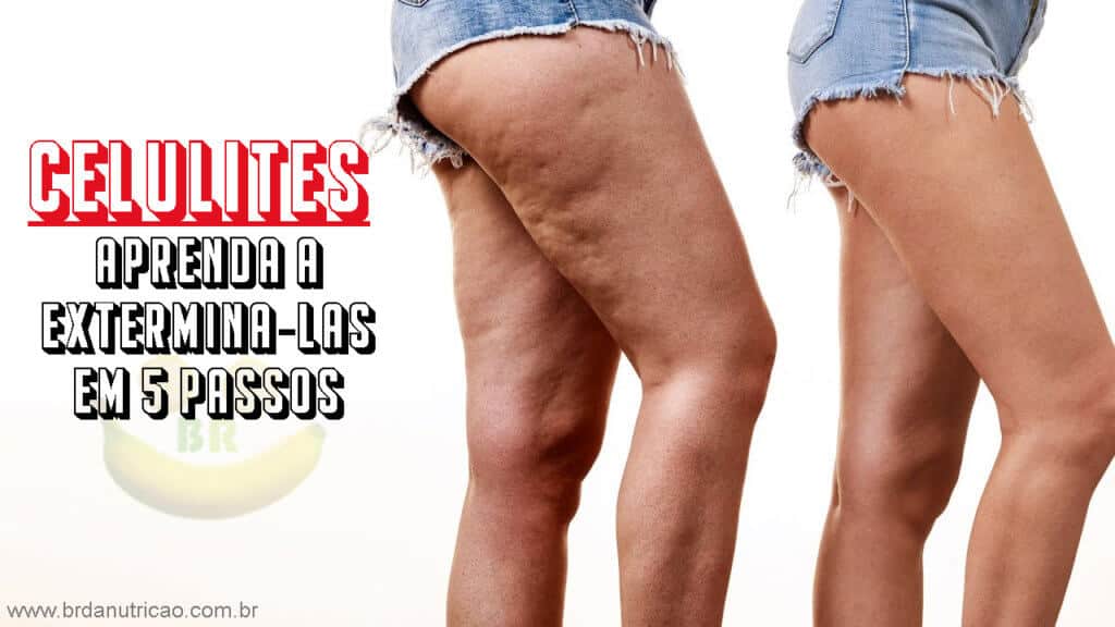 o que é celulite