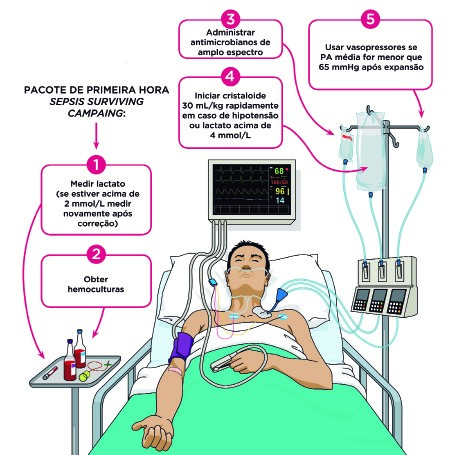 erros comuns no tratamento de choque séptico que você deve evitar