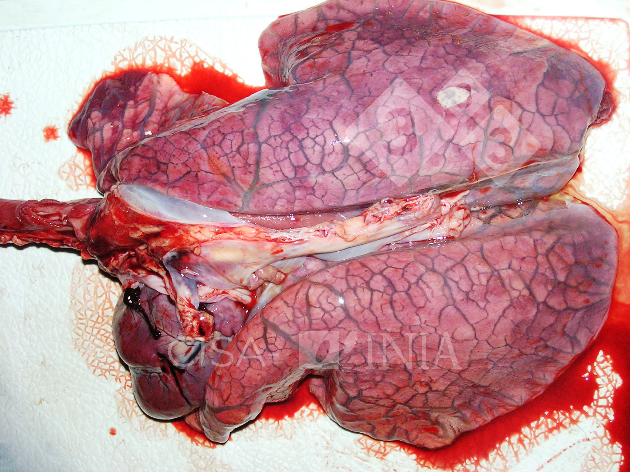 sintomas de falta de ar súbita