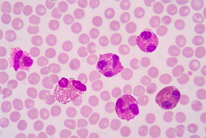 o que é eosinófilos no exame de sangue
