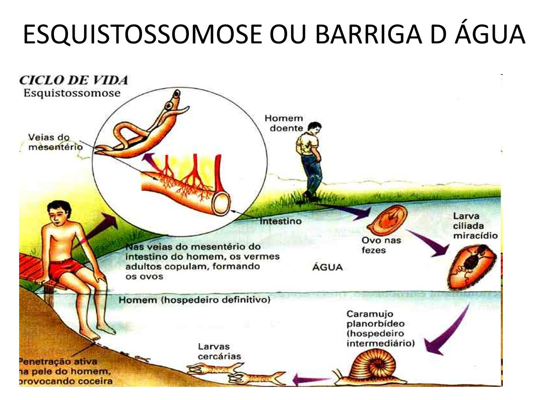 principais formas de prevenir esquistossomose em áreas de risco