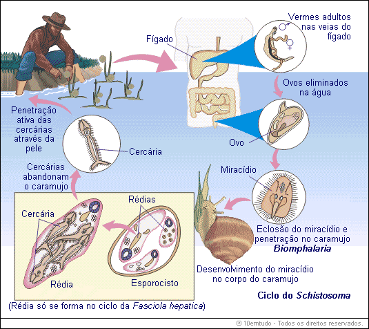erros comuns no diagnóstico da esquistossomose