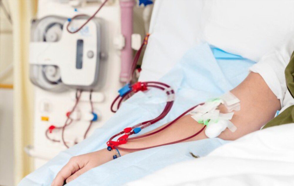 Como funciona o rim artificial?