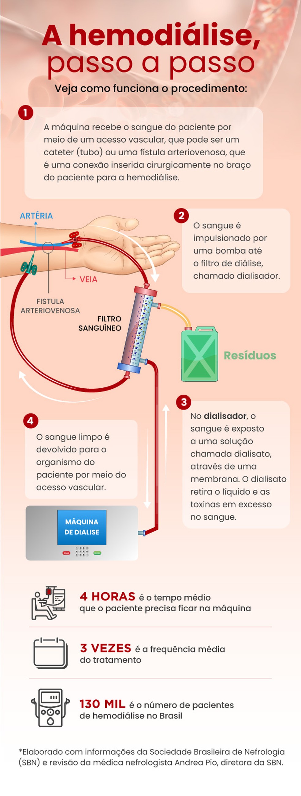 Quais os tipos de acesso vascular para hemodiálise?