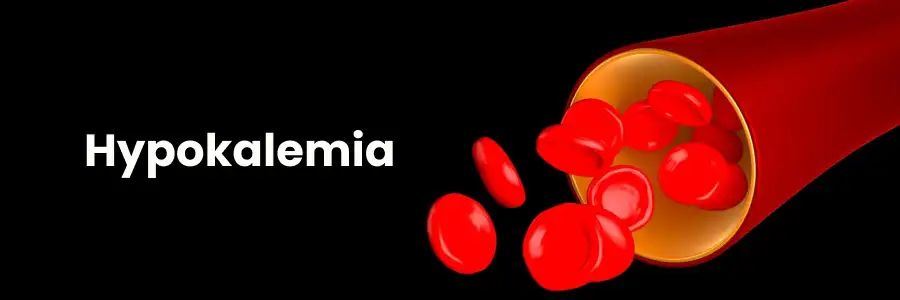 o que é hipocalemia