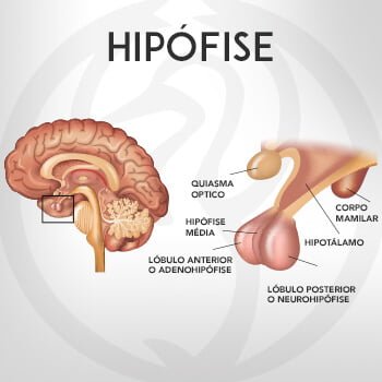 erros comuns ao diagnosticar problemas na hipófise