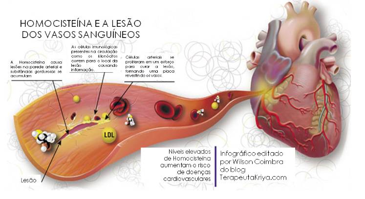 o que é homocisteína