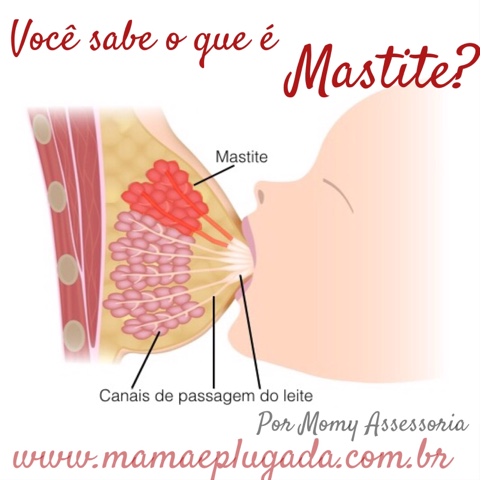 o que é mastite