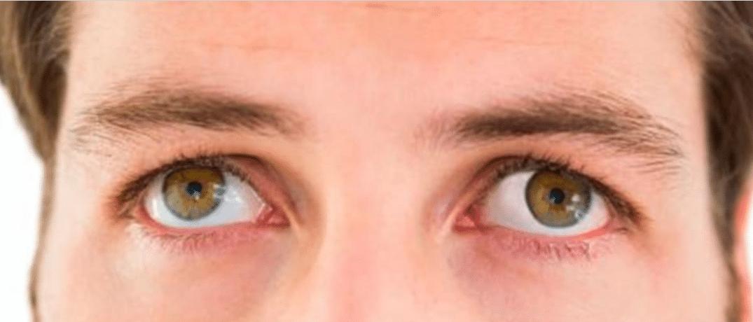 tipos de nistagmo e suas características