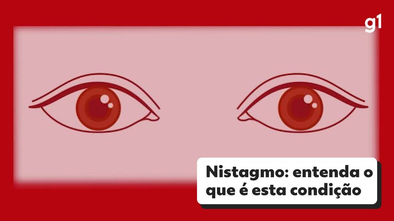 erros comuns no diagnóstico de nistagmo