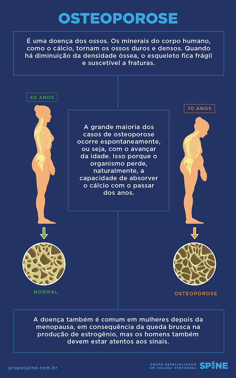 o que é osteoporose
