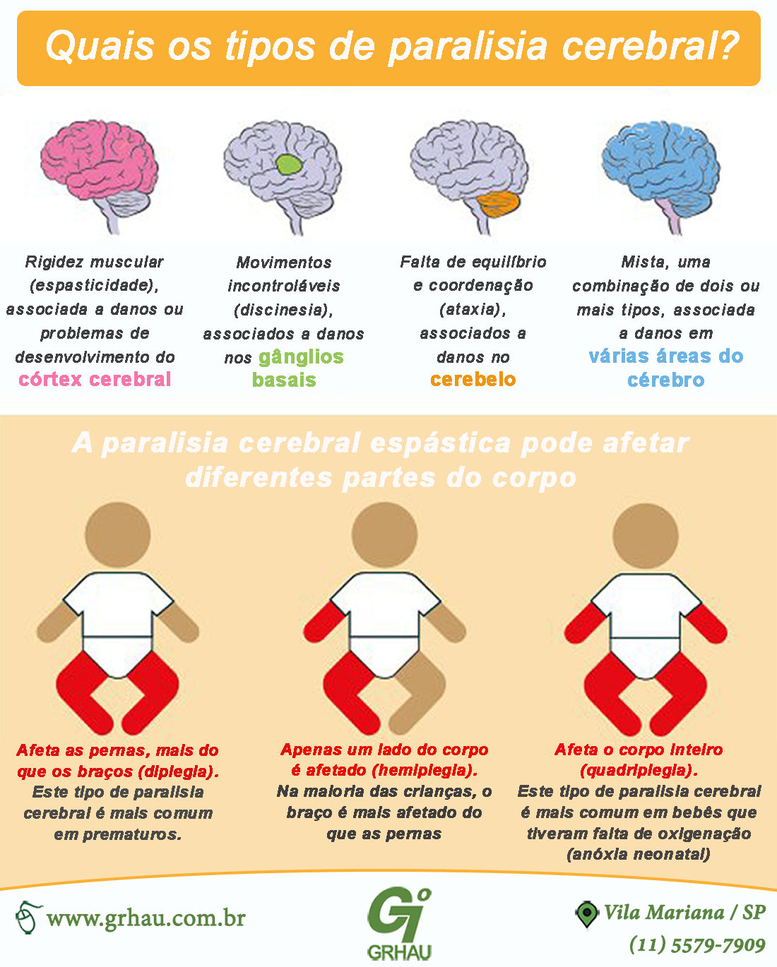 sintomas de paralisia cerebral