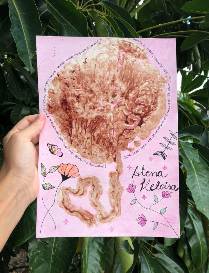 tipos de placenta e suas características