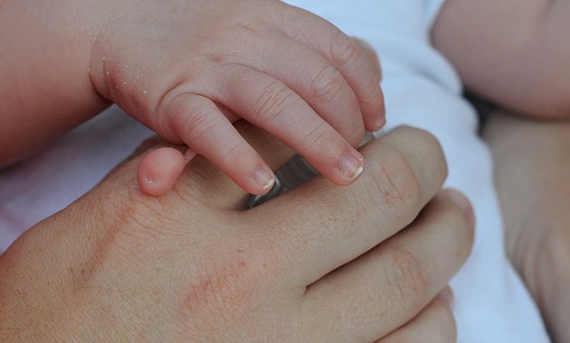 tipos de polidactilia e como são tratadas