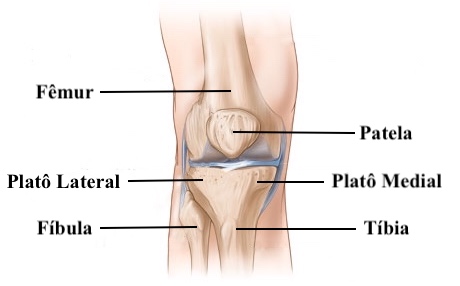 erros comuns ao tratar dor na canela