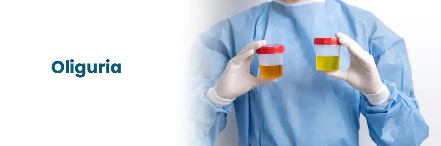 erros comuns no diagnóstico de oligúria