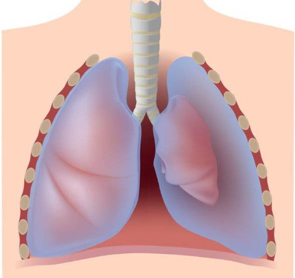 erros comuns no diagnóstico de pneumotorax