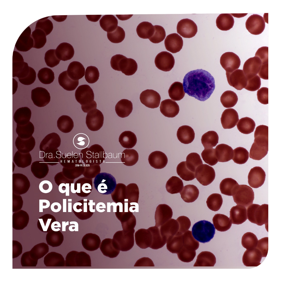 tratamento para policitemia