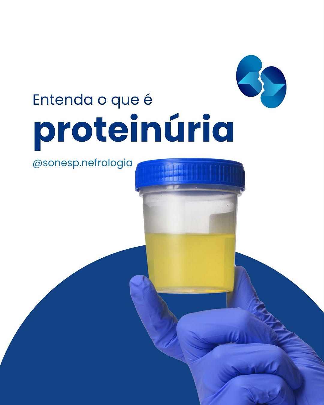 o que causa proteinúria