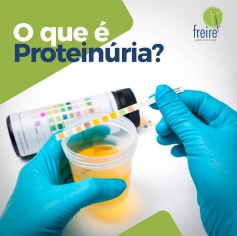 sintomas de proteína na urina