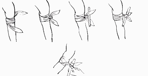 melhores torniquetes para emergência