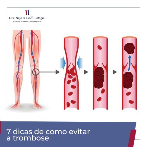 trombofilia o que é
